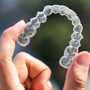 clear aligner