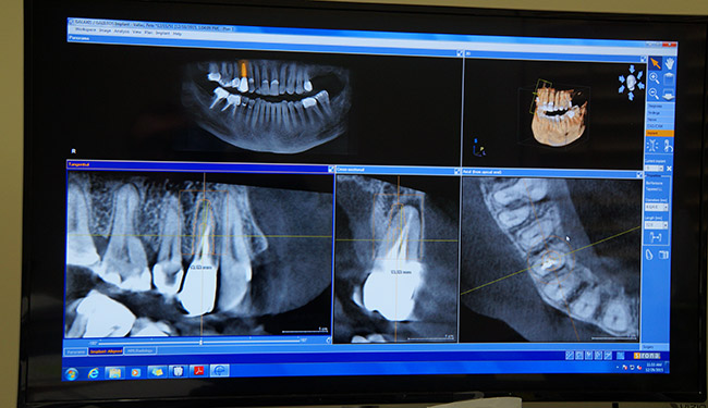 dental x-rays