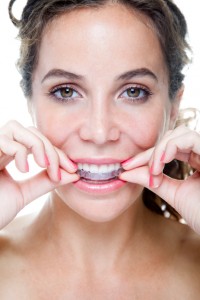 Your dentist for clear braces in Mobile with Invisalign.