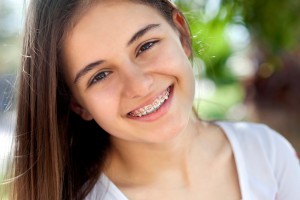 West Mobile orthodontics can improve your smile and your life.