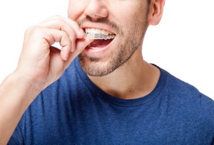Why should I get Invisalign in West Mobile?