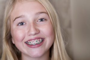 girl blonde hair braces smiling