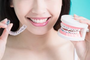 clear aligner and braces