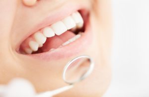 A person undergoing a dental exam.