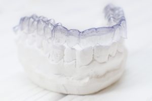 Invisalign on dental mold for bite problems. 