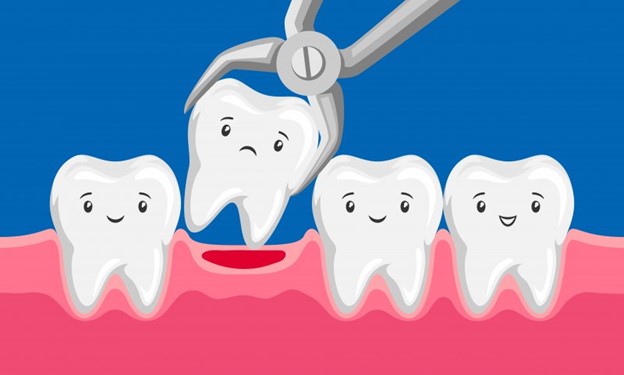 Cartoon illustration of tooth being removed by forceps.